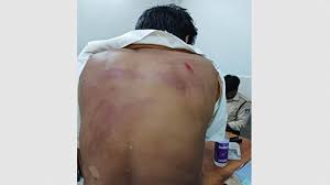 burhanpur, Bullies dragged ,couple and beat 