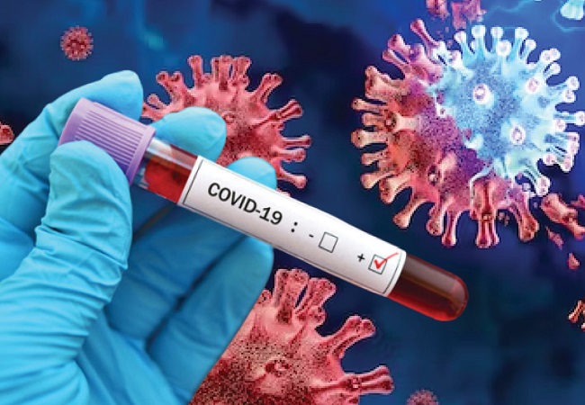 bhopal, Third corona positive, woman dies 
