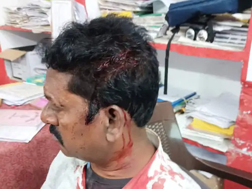 anuppur, Two parties injured ,old dispute