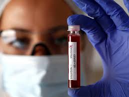 bhopal, Four new corona, infected patients, found in Indore, number increased 