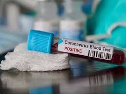 bhopal, Corona infected, MP 8199, 354 have died