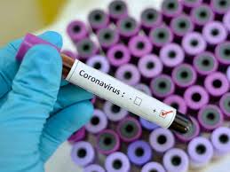 indore,Three more deaths, corona ,57 new positives
