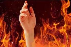 dindori, Scorching woman ,dies ,during treatment ,fire