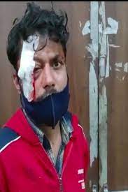 indore, One miscreant, fired at another, shrapnel in the eye
